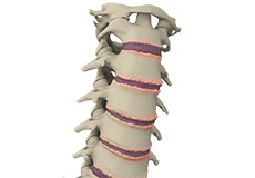 Surgical Treatment for Spine Conditions